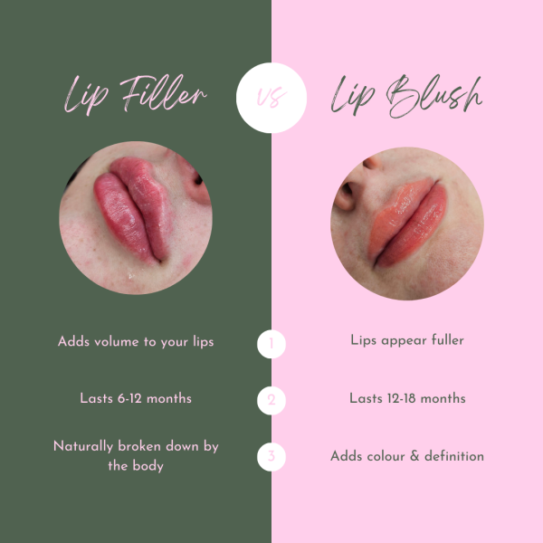Lip Treatments Lip Blush vs Lip Filler Be Beau With Grace
